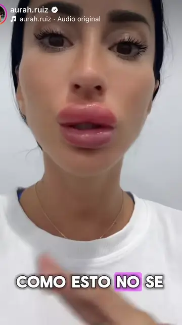 Aurah Ruiz se quita labios Aurah Ruiz se quita labios
