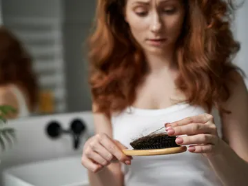 Caída de pelo Caída de pelo