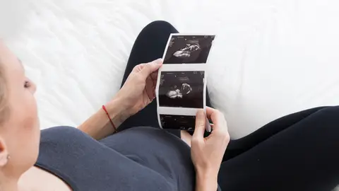 Una mujer con una ecografía Una mujer con una ecografía