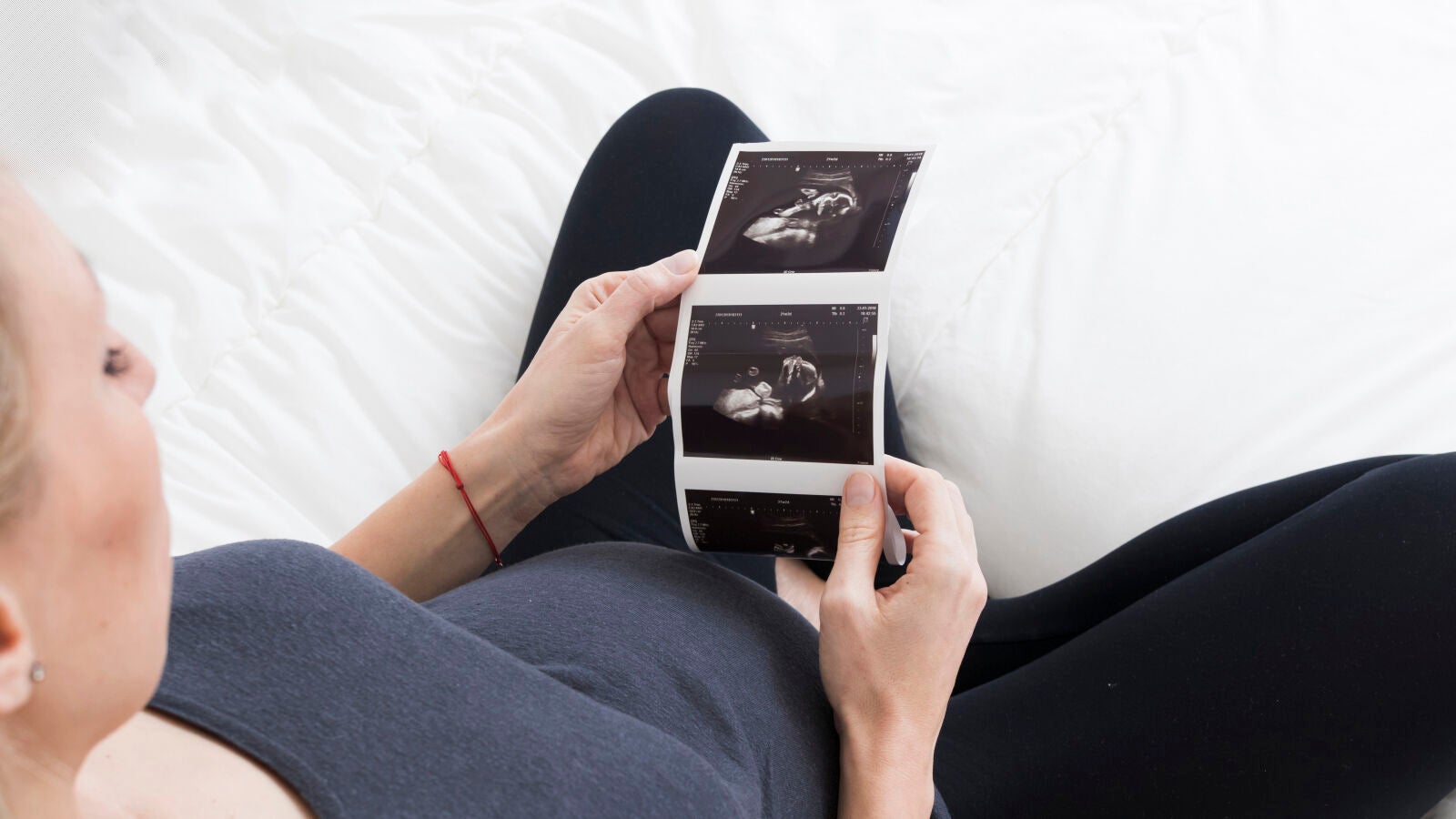 Todo lo que debes saber antes de iniciar un tratamiento de fertilidad para ser madre