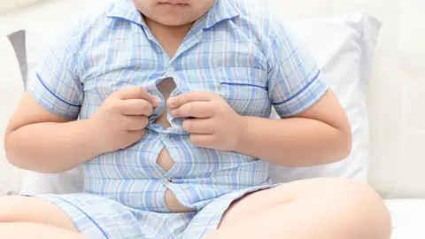 Un niño con obesidad Un niño con obesidad