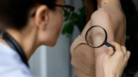 Paciente en la consulta de la dermatóloga Paciente en la consulta de la dermatóloga