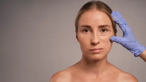 Mujer con marca en la zona de la ojera Mujer con marca en la zona de la ojera