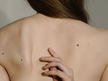 Imagen de archivo de piel Imagen de archivo de piel