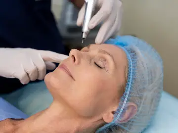 Paciente en una cirugía estética de párpados Paciente en una cirugía estética de párpados