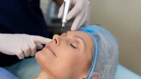 Paciente en una cirugía estética de párpados Paciente en una cirugía estética de párpados