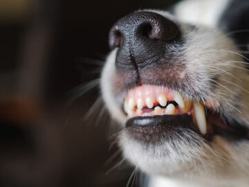 Mordedura de perro