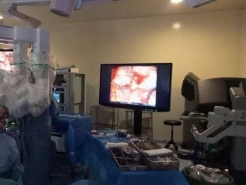 Extirpan un tumor de próstata con una sola incisión