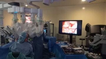 Extirpan un tumor de próstata con una sola incisión