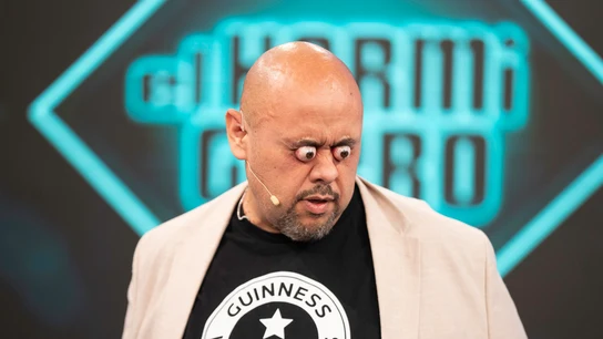 ¡Increíble! Marron trae el Récord Guinness mayor protrusión ocular a El Hormiguero ¡Increíble! Marron trae el Récord Guinness mayor protrusión ocular a El Hormiguero