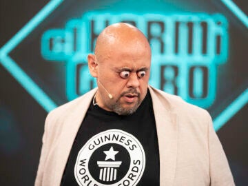 ¡Increíble! Marron trae el Récord Guinness mayor protrusión ocular a El Hormiguero