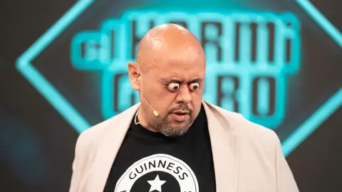 ¡Increíble! Marron trae el Récord Guinness mayor protrusión ocular a El Hormiguero ¡Increíble! Marron trae el Récord Guinness mayor protrusión ocular a El Hormiguero