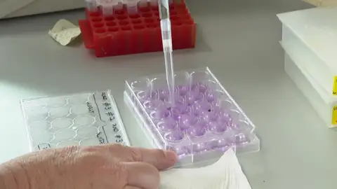 Importante descubrimiento: Encuentran anticuerpos cargados de agentes tóxicos para destruir las células tumorales en el cáncer de páncreas Importante descubrimiento: Encuentran anticuerpos cargados de agentes tóxicos para destruir las células tumorales en el cáncer de páncreas