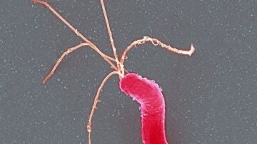 Bacteria Helicobacter Pilory