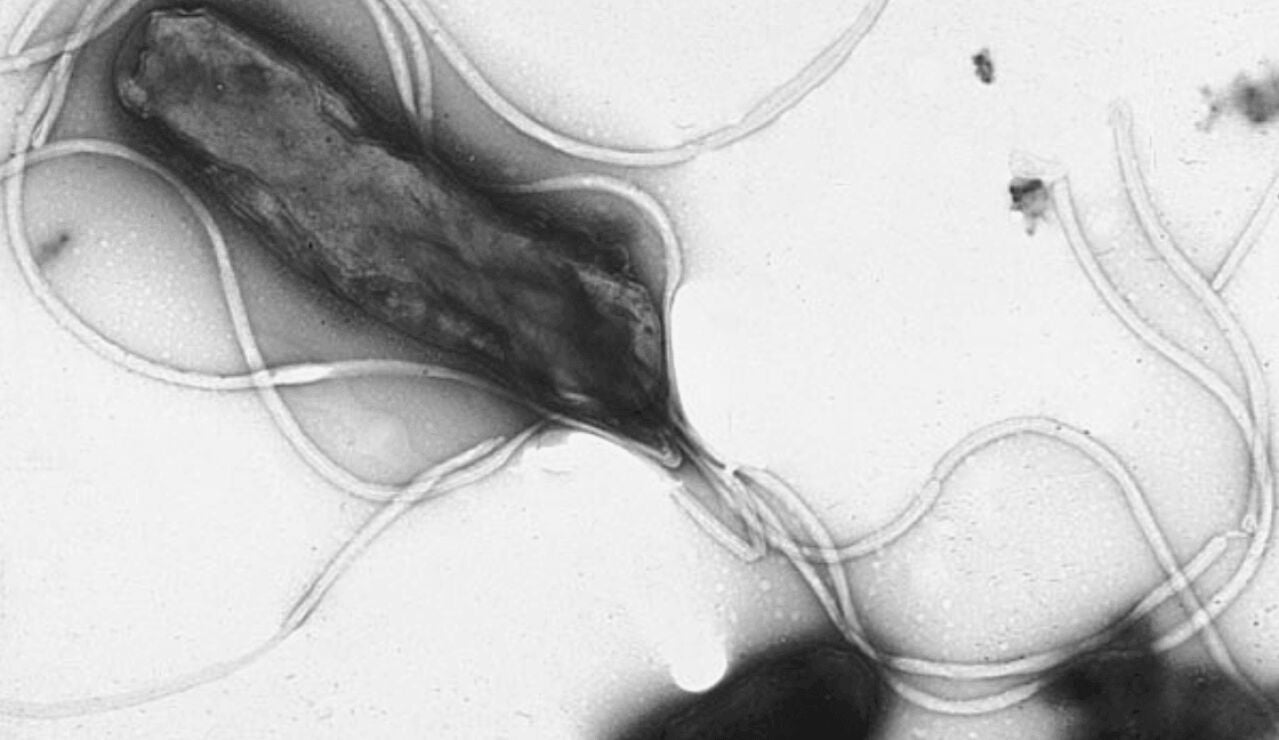 Helicobacter pylori bajo microscopio