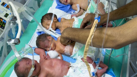 Cuatro ni&ntilde;os mueren de desnutrici&oacute;n en Gaza en las &uacute;ltimas 48 horas