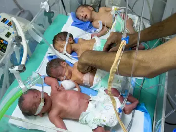 Cuatro niños mueren de desnutrición en Gaza en las últimas 48 horas Cuatro niños mueren de desnutrición en Gaza en las últimas 48 horas
