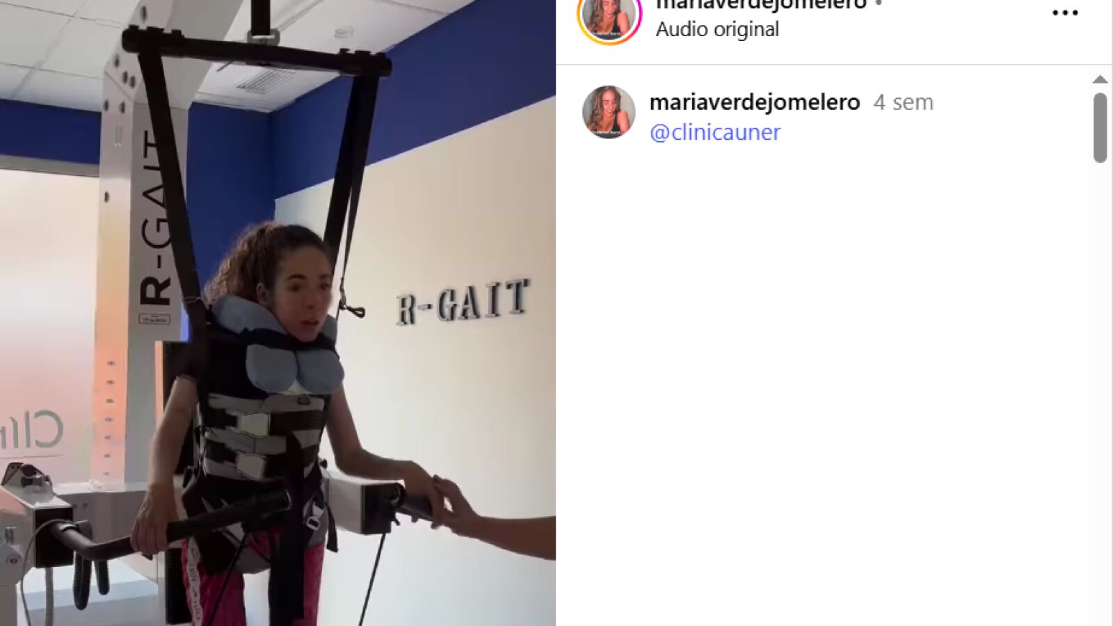 Qué le pasó a Marta Pérez, la joven de 19 años en estado vegetativo por una alergia a los frutos secos