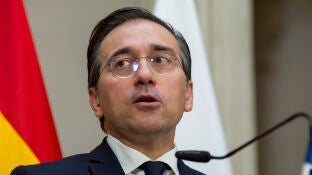 Ministro Albares