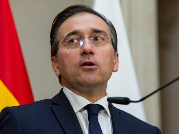 Ministro Albares