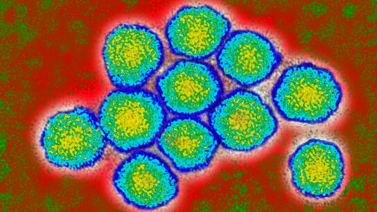 Virus de la Hepatitis C