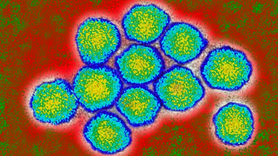 Virus de la Hepatitis C Virus de la Hepatitis C