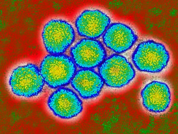 Virus de la Hepatitis C Virus de la Hepatitis C