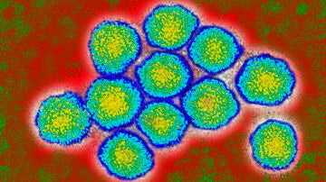 Virus de la Hepatitis C
