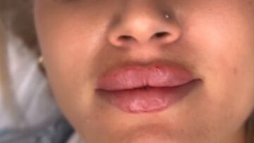 Labios