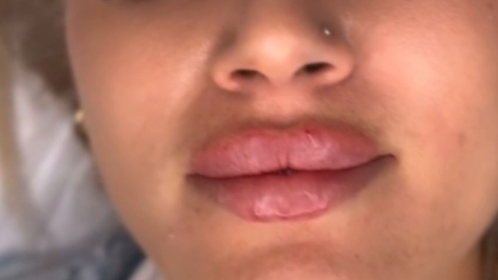 Detenida la dueña de una clínica estética clandestina: “Vino la secreta, se lío mucho”