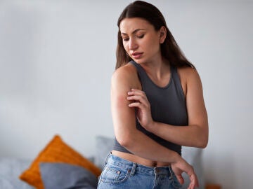 Mujer con una picada de mosquito