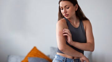 Mujer con una picada de mosquito