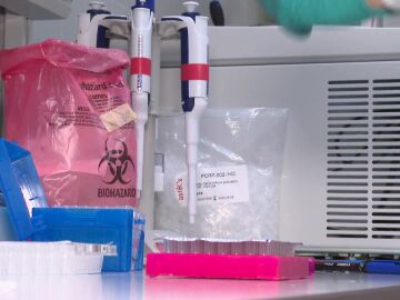 Investigación alzhéimer
