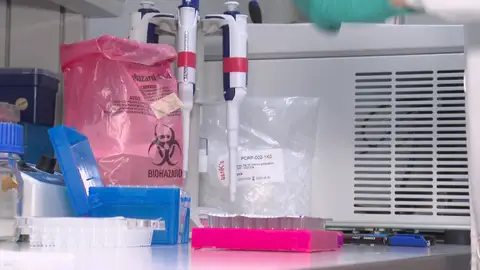 Investigación alzhéimer Investigación alzhéimer