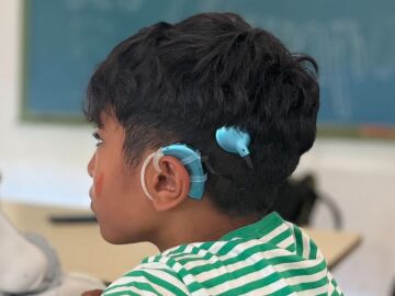 Búsqueda desesperada en Huelva: roban el implante coclear de un niño y sin él no puede oír