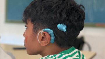 Búsqueda desesperada en Huelva: roban el implante coclear de un niño y sin él no puede oír