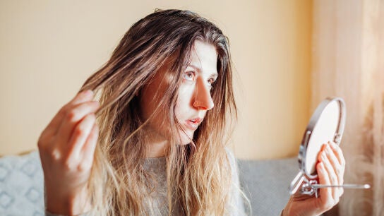 Pelo graso