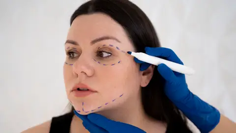 Preparación del rostro para retoques faciales Preparación del rostro para retoques faciales