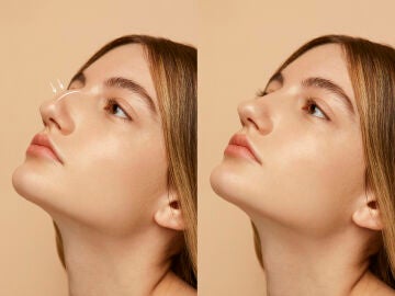 Retoque est&eacute;tico en la nariz de una mujer