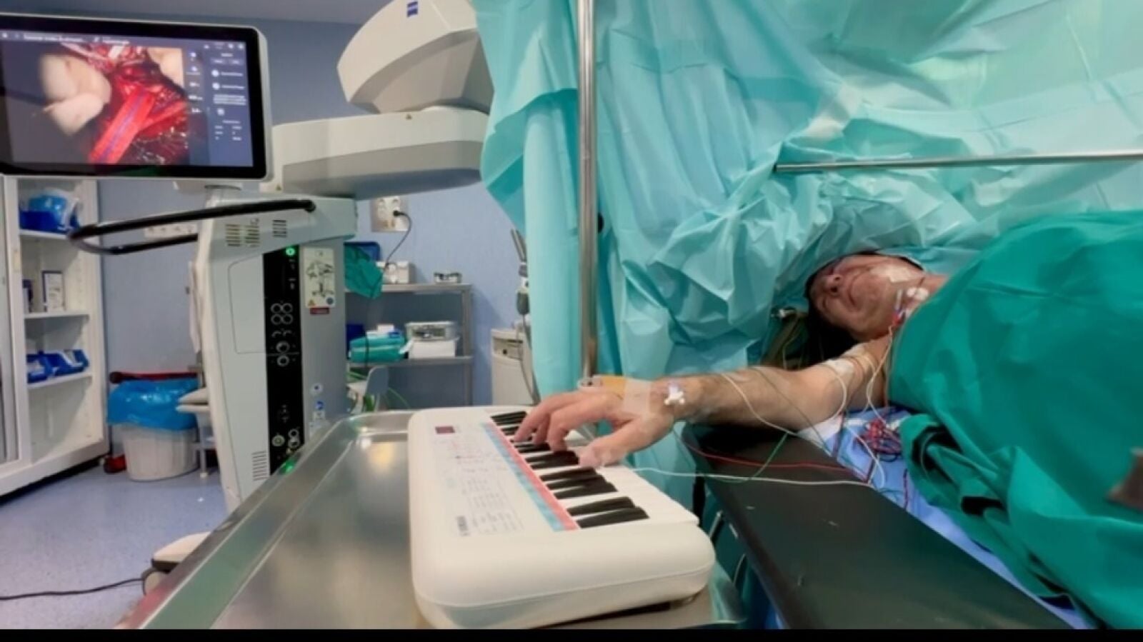 El hospital Cruz Roja de Córdoba realiza con éxito una cirugía cerebral mientras el paciente toca el piano