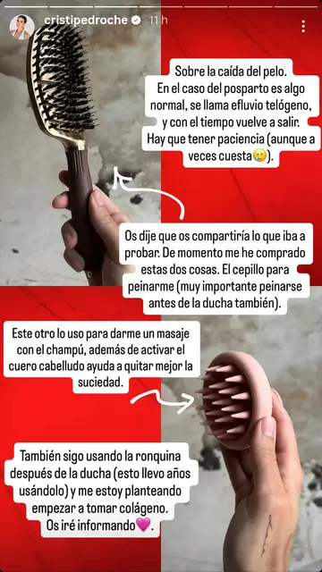 Historia de Instagram de Cristina Pedroche sobre su efluvio telógeno Historia de Instagram de Cristina Pedroche sobre su efluvio telógeno