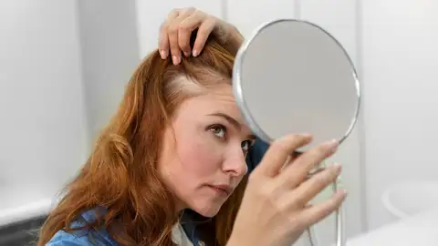 Mujer que sufre caída de pelo Mujer que sufre caída de pelo