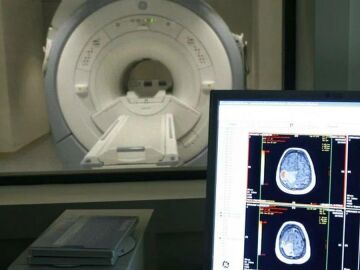 Imagen de archivo de un tomógrafo y de un TAC.