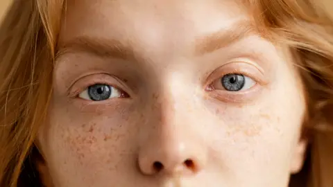 Mujer con pecas Mujer con pecas
