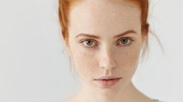 Mujer con pecas