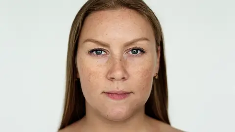 Mujer con manchas y pecas Mujer con manchas y pecas