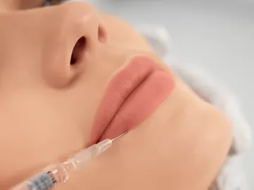 Una mujer se realiza un tratamiento de estética en los labios Una mujer se realiza un tratamiento de estética en los labios