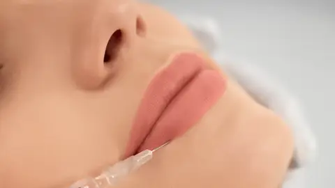 Una mujer se realiza un tratamiento de estética en los labios Una mujer se realiza un tratamiento de estética en los labios