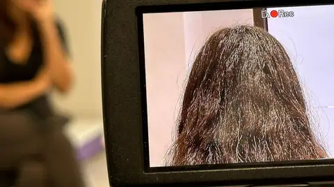 "Su vida queda marcada para siempre", padres y víctimas del ciberacoso aplauden la ley gallega que permitirá borrar la huella digital "Su vida queda marcada para siempre", padres y víctimas del ciberacoso aplauden la ley gallega que permitirá borrar la huella digital