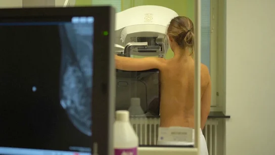 Detección del cáncer de mama Antena3 Noticias